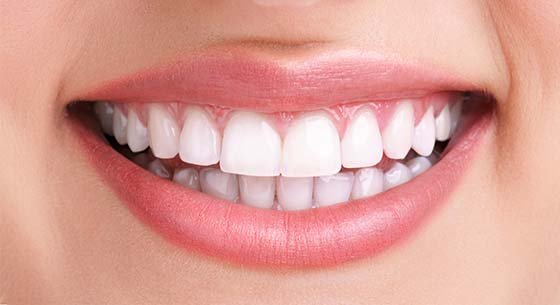 Teeth Cleaning After